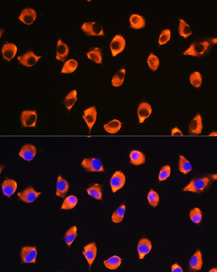 KIF21A Polyclonal Antibody