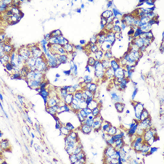 STARD3NL Polyclonal Antibody