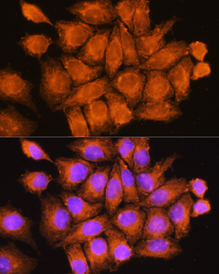 CFAP53 Polyclonal Antibody