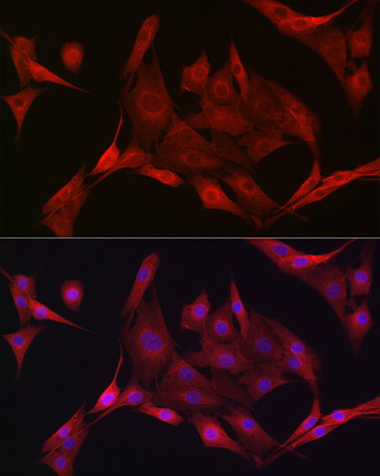 PRKAA1/PRKAA2 Polyclonal Antibody