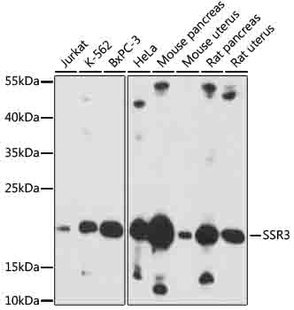 SSR3 Polyclonal Antibody