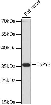 TSPY3 Polyclonal Antibody