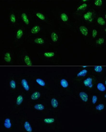 DHX9 Polyclonal Antibody