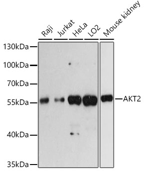 [KO Validated] AKT2 Monoclonal Antibody