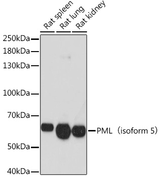 PML(isoform 5) Polyclonal Antibody