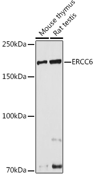 ERCC6 Polyclonal Antibody
