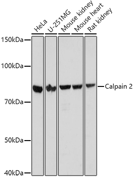 [KO Validated] CAPN2 Polyclonal Antibody