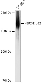 [KO Validated] HER2 / ErbB2 Polyclonal Antibody