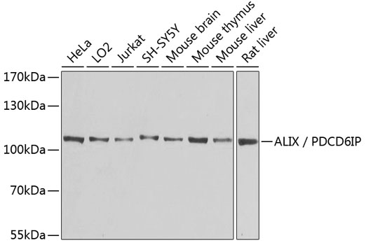 ALIX / PDCD6IP Polyclonal Antibody