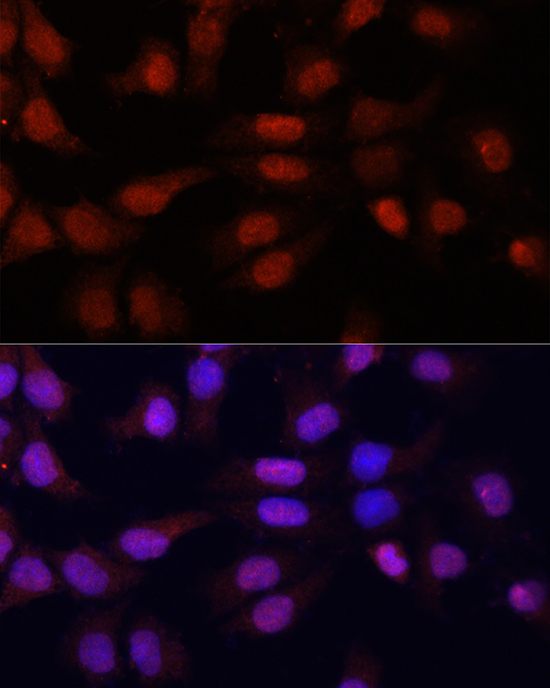 N5-Methylcytidine Polyclonal Antibody