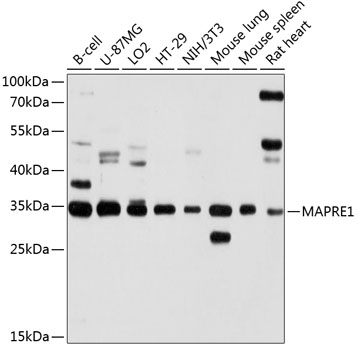 MAPRE1 Polyclonal Antibody