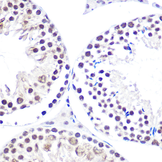 NELFE Polyclonal Antibody