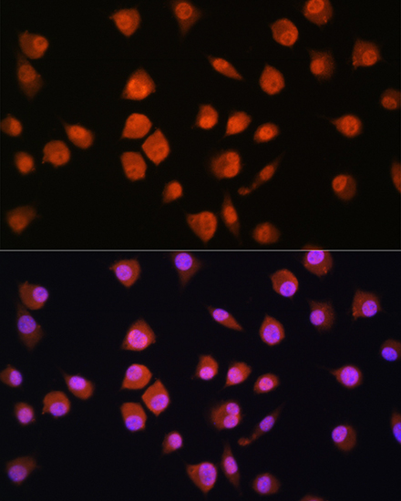 NPLOC4 Polyclonal Antibody