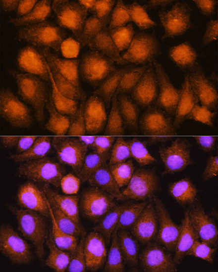 ASNA1 Polyclonal Antibody