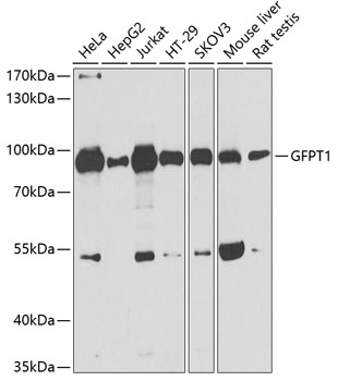 GFPT1 Polyclonal Antibody