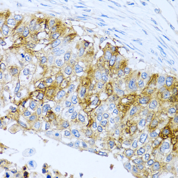 IFIT3 Polyclonal Antibody
