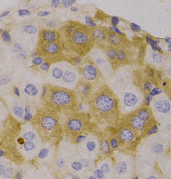NBR1 Polyclonal Antibody