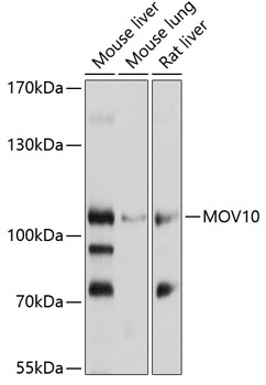 MOV10 Polyclonal Antibody