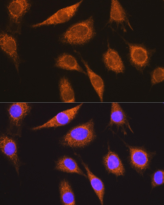 MUT Polyclonal Antibody