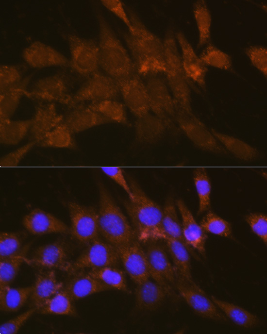 OSBP Polyclonal Antibody