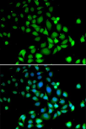 PARN Polyclonal Antibody