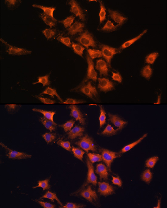 PFDN5 Polyclonal Antibody