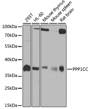 [KO Validated] PPP1CC Polyclonal Antibody