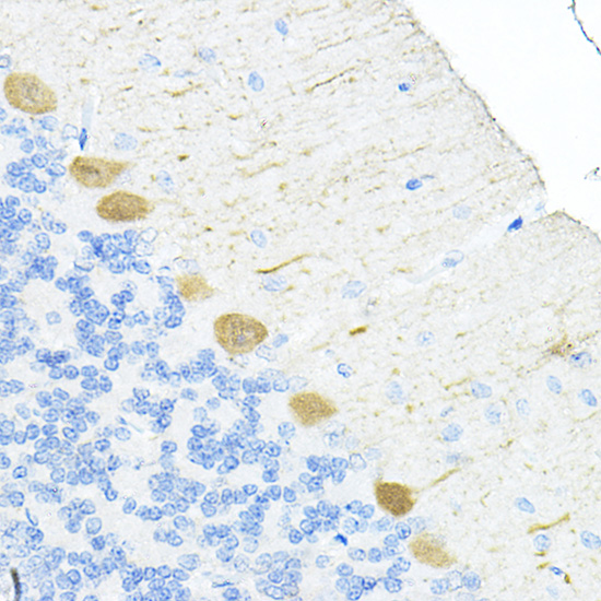 [KO Validated] S100A6 Polyclonal Antibody