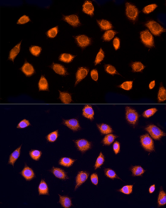 RPH3AL Polyclonal Antibody