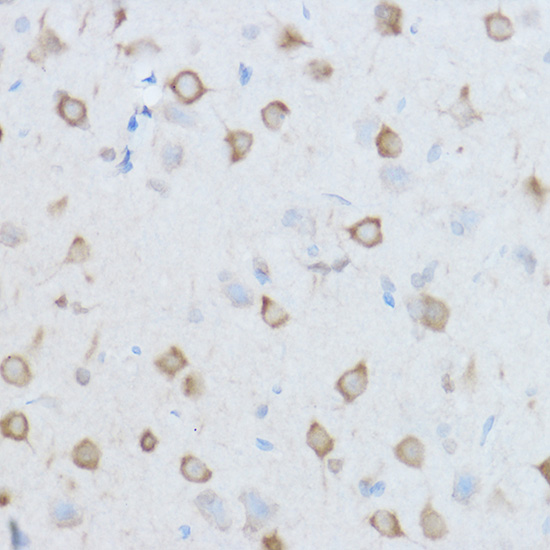 CCT8 Polyclonal Antibody