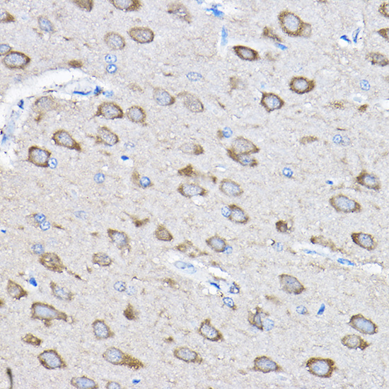 PTPN23 Polyclonal Antibody