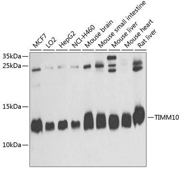 TIMM10 Polyclonal Antibody