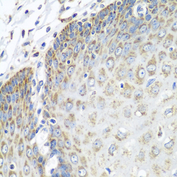 TMOD3 Polyclonal Antibody