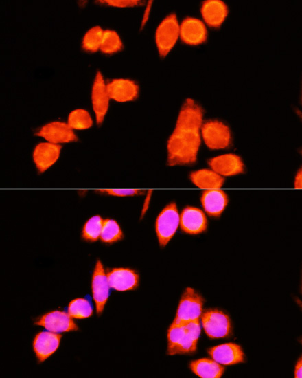 DNAJC19 Polyclonal Antibody