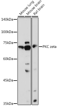PRKCZ Polyclonal Antibody
