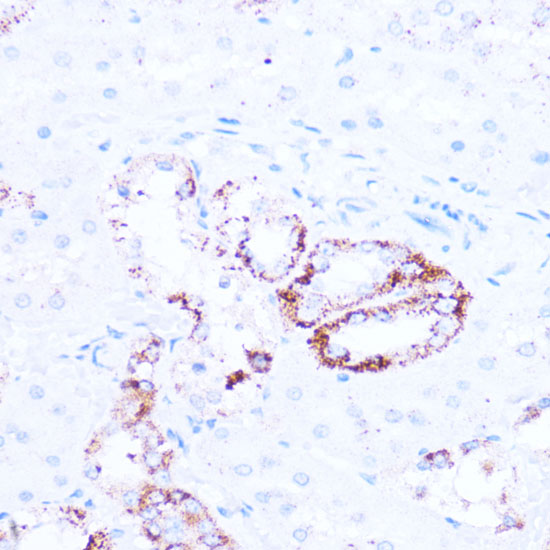 [KO Validated] SIRT3 Polyclonal Antibody