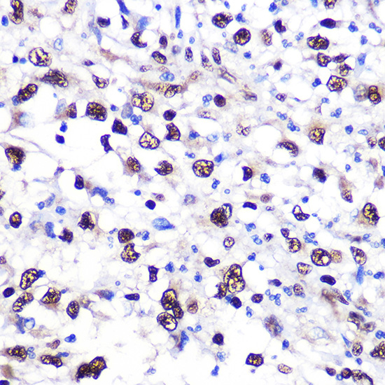 NCL Polyclonal Antibody