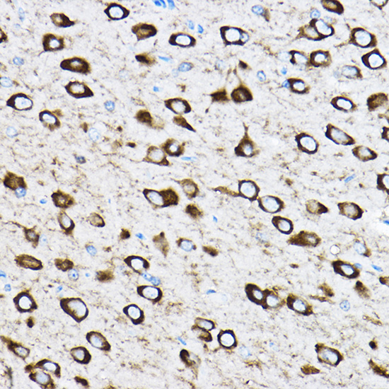 RPL17 Polyclonal Antibody