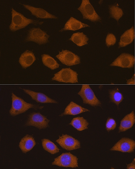 CSDE1 Polyclonal Antibody