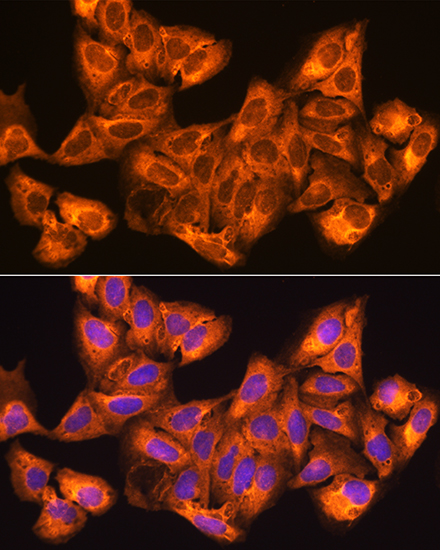 ZCCHC11 Polyclonal Antibody
