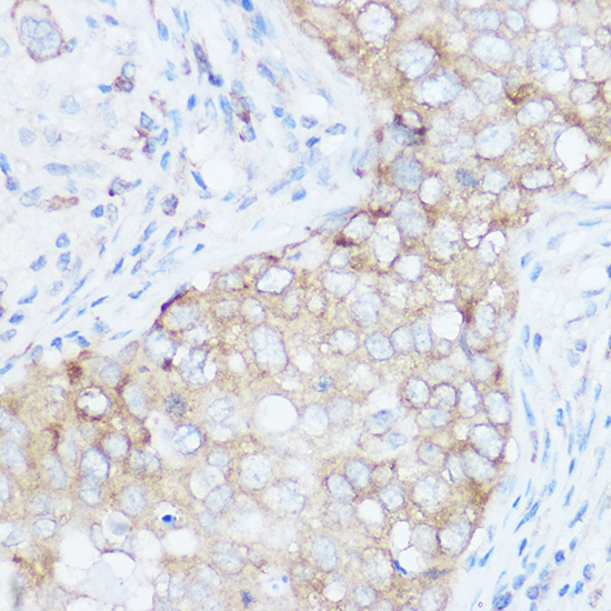 EIF4G Polyclonal Antibody