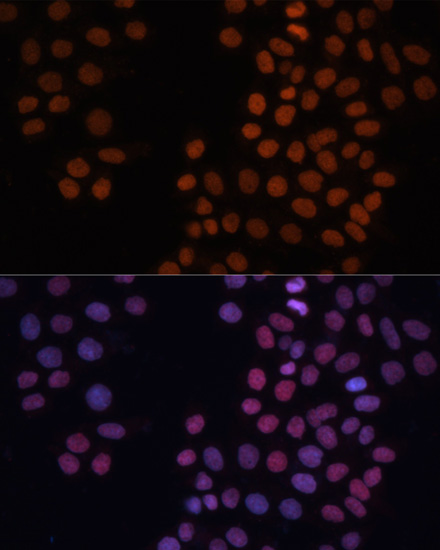 HMGN1 Polyclonal Antibody