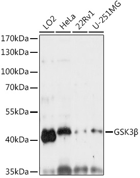 [KO Validated] GSK3B Polyclonal Antibody