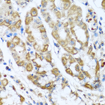 ANTXR2 Polyclonal Antibody