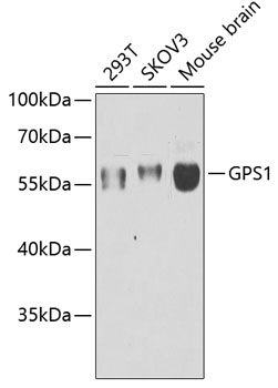 GPS1 Polyclonal Antibody
