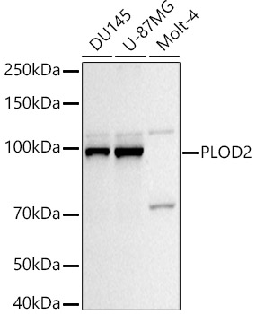 PLOD2 Polyclonal Antibody