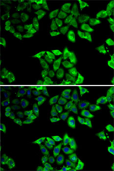 PPID Polyclonal Antibody