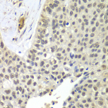SNRPD2 Polyclonal Antibody