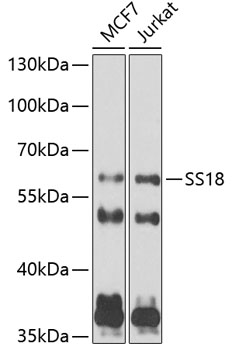 SS18 Polyclonal Antibody