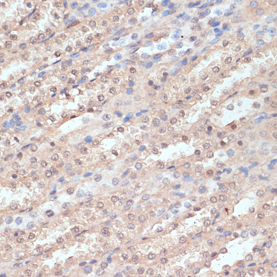 NAA20 Polyclonal Antibody